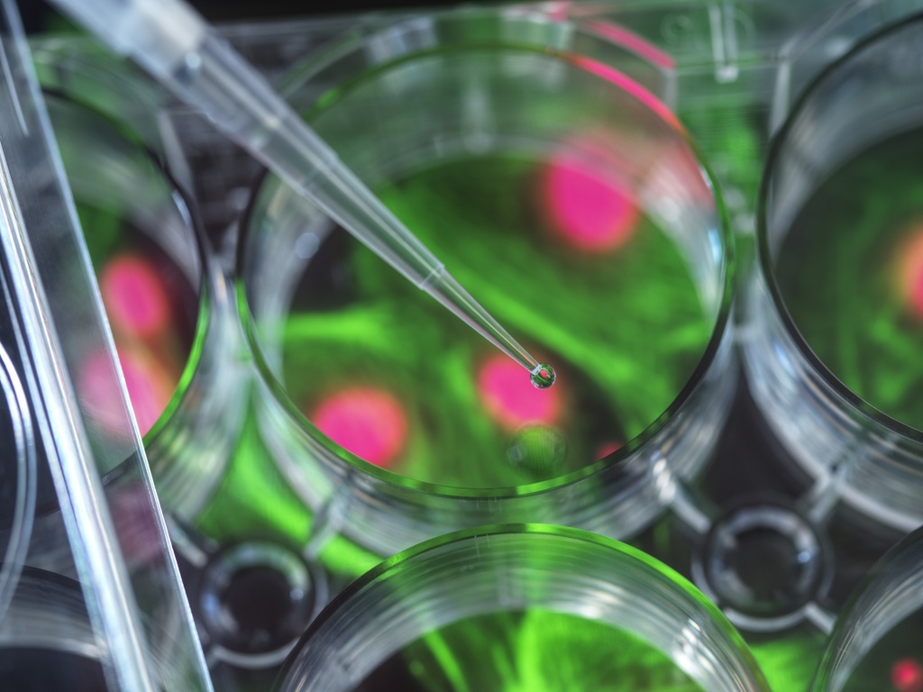 Green Fluorescent  Human Lung Adenocarcinoma Cell Line (XWLC-05+GFP)